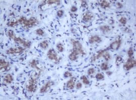 Monoclonal Mouse anti-Human DDX59 Antibody (clone OTI2G1, IHC, WB)