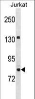 NIRF / UHRF2 Antibody (aa479-508)
