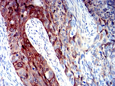 ALDH1A1 / ALDH1 Antibody (clone 2B2G1)