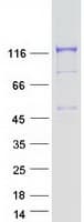 Human CYFIP2 / PIR121 Protein (Recombinant Myc-DDK (Flag))