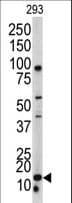 Polyclonal Rabbit anti-Human BAALC Antibody (aa41-68, IHC, WB)