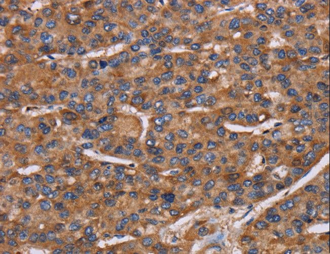 NCSTN / Nicastrin Antibody