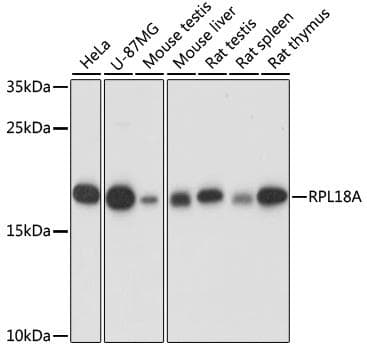 Polyclonal Rabbit anti-Human RPL18A Antibody (WB)