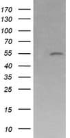 MDM4 / MDMX Antibody (clone OTI4D2)