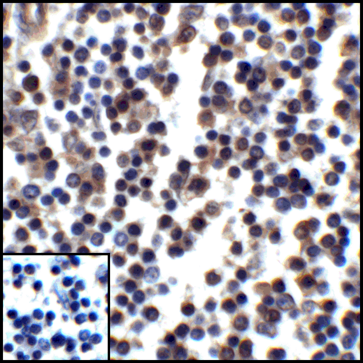 CD274 / B7-H1 / PD-L1 Antibody (clone 8E12)