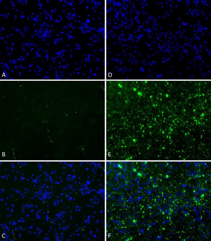 Human SNCA / Alpha-Synuclein Protein (Recombinant)