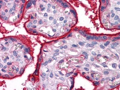 Monoclonal Mouse anti-Human ITGA5/Integrin Alpha 5/CD49e Antibody (clone 10F6, IHC, WB)