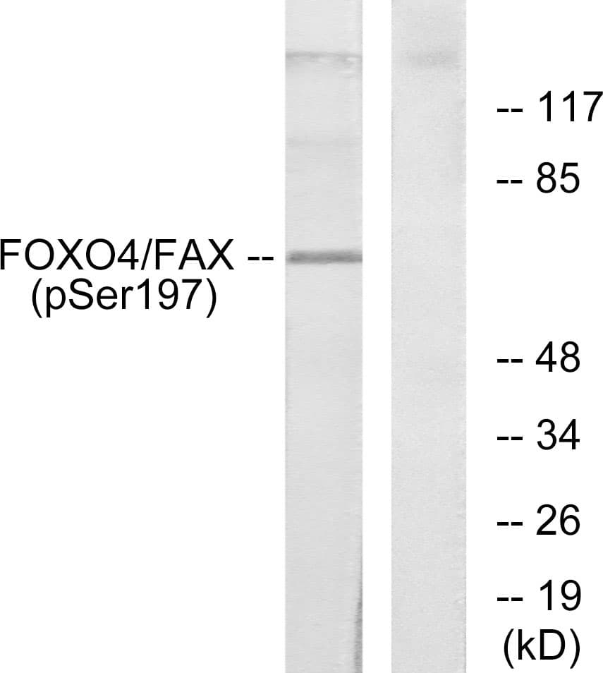 Polyclonal Rabbit anti-Human FOXO4 / AFX1 Antibody (phospho-Ser197, IHC, WB)