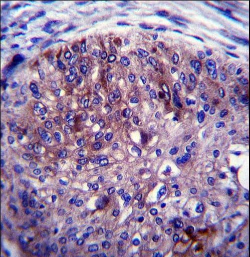 Polyclonal Rabbit anti-Human ADAL Antibody (aa317-344, IHC, WB)