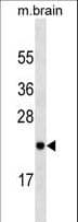 RAB23 Antibody (aa1-197)