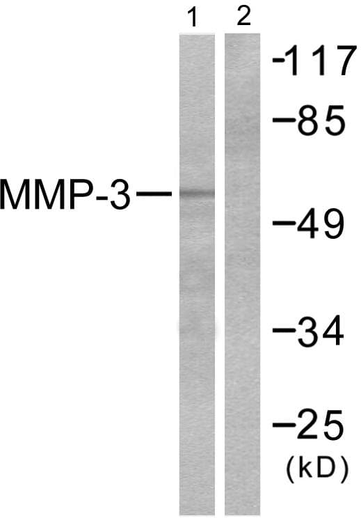 MMP3 Antibody