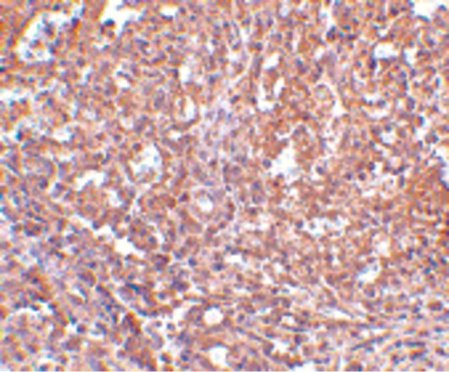 TMEM142A / ORAI1 Antibody