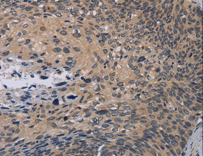 Polyclonal Rabbit anti-Human NOX1 Antibody (IHC)
