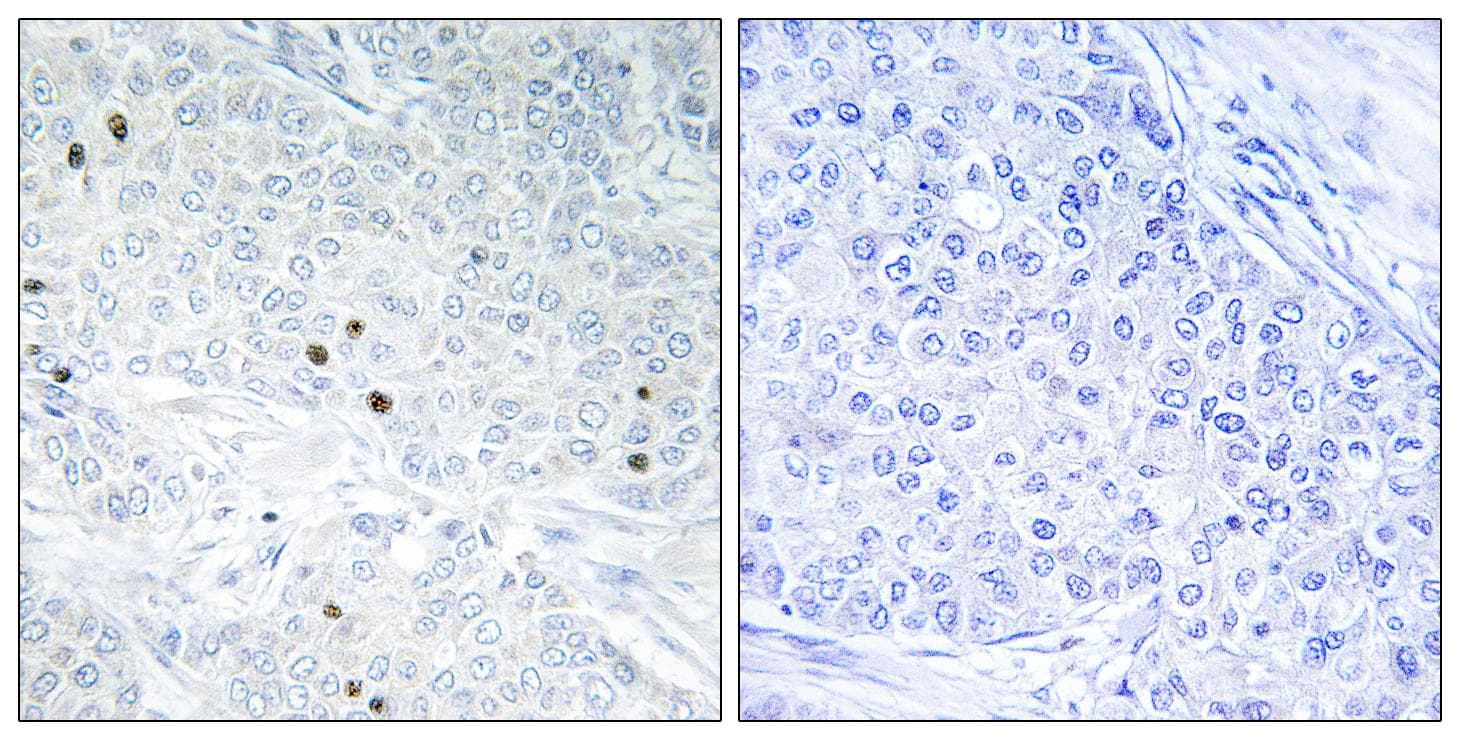 Polyclonal Rabbit anti-Human TP53INP2 Antibody (IHC, IF)