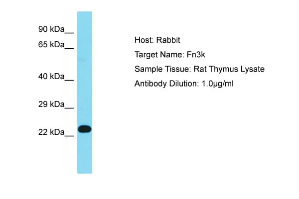 Polyclonal Rabbit anti-Rat FN3K / Fructosamine-3-Kinase Antibody (aa67-116, WB)