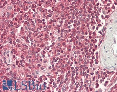 IHC-plus™ SMO / Smoothened Antibody (N-Terminus)