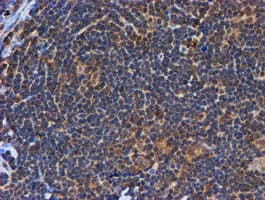 PSMB9 Antibody (clone OTI2B6)