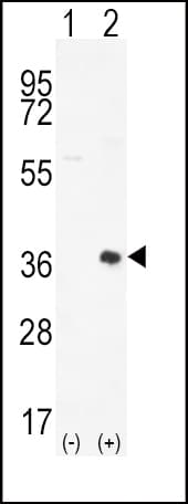 PIM2 / Pim-2 Antibody (aa277-308)