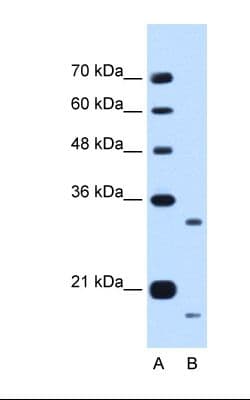 CCPG1 / CRP8 Antibody (aa301-350)