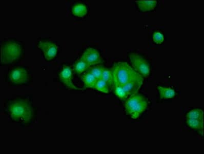 Polyclonal Rabbit anti-Human RUSC1 Antibody (IHC)