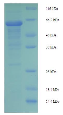 Human MAPK9 / JNK2 Protein (Recombinant 6His-SUMO, N-terminus)