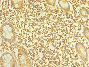 TAC1 Antibody (aa1-129)