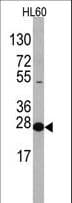 EIF4E Antibody (aa32-61)