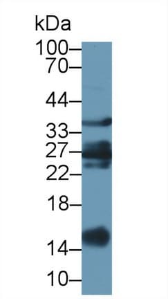 LGALS1 / Galectin 1 Antibody (aa2-135)