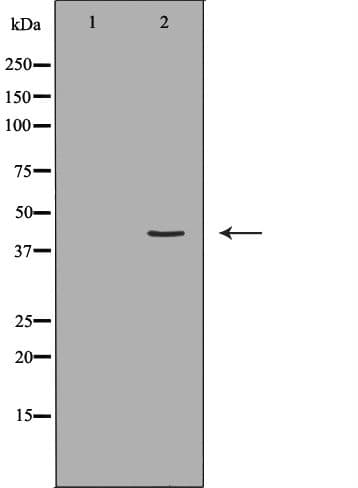 HLA-A Antibody