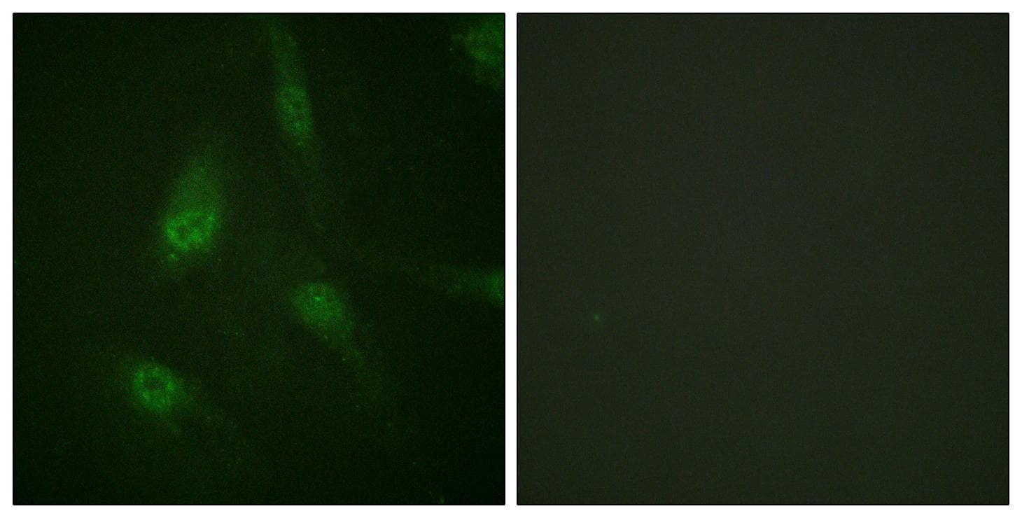 NFAT4 / NFATC3 Antibody (phospho-Ser165)