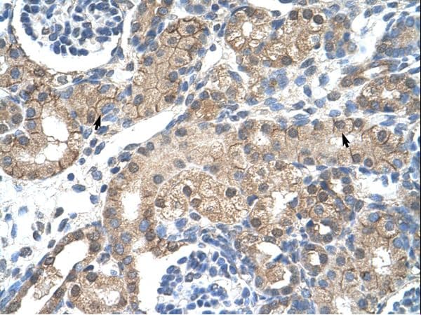 CHRNB2 Antibody (aa155-204)