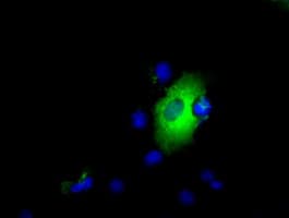 LIPG / Endothelial Lipase Antibody (clone OTI1D9, Carrier-free)