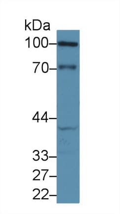CDH1 / E Cadherin Antibody (aa375-631)