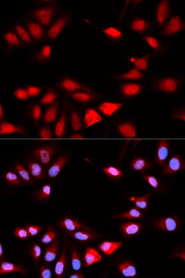 RCAN1 / DSCR1 Antibody