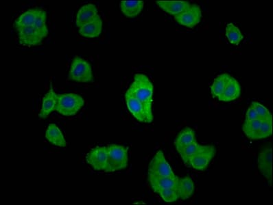 CD2AP Antibody