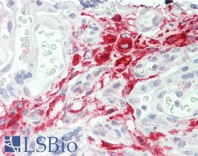 IHC-plus™ ARA9 / AIP Antibody (Internal)