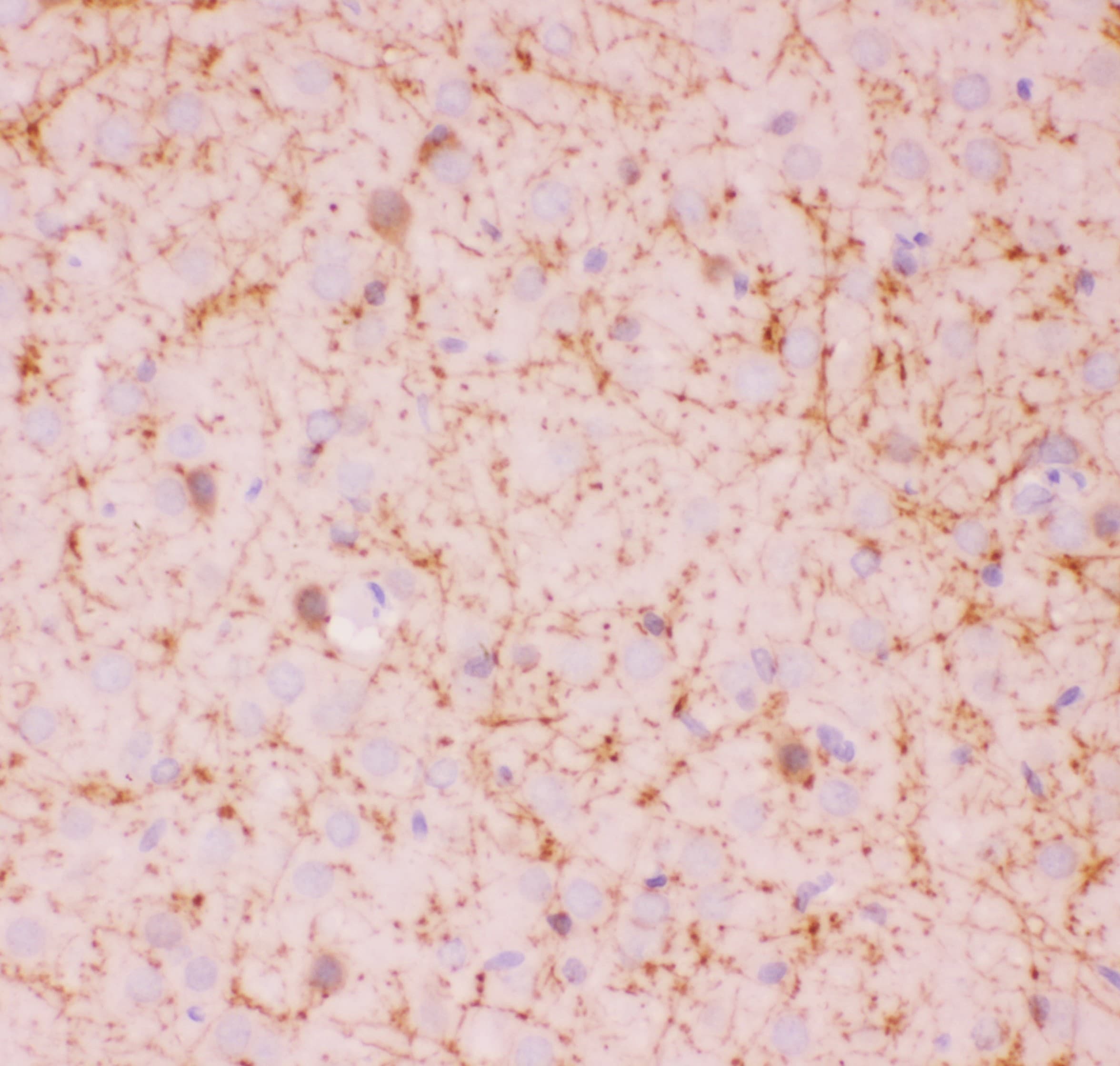 SIRT2 / Sirtuin 2 Antibody (aa165-187)