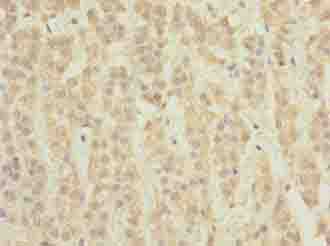 TCTA Antibody
