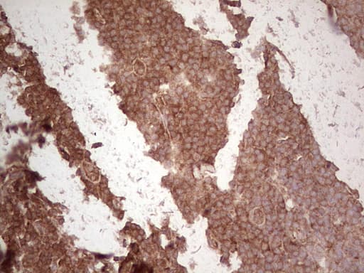 UBE2D2 / UBCH5B Antibody (clone OTI2C2)
