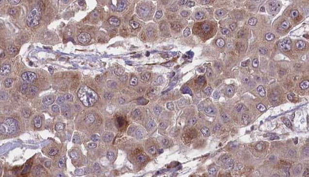 CEACAM5 / CD66e Antibody