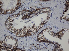 CDH1 / E Cadherin Antibody (clone OTI1B11)