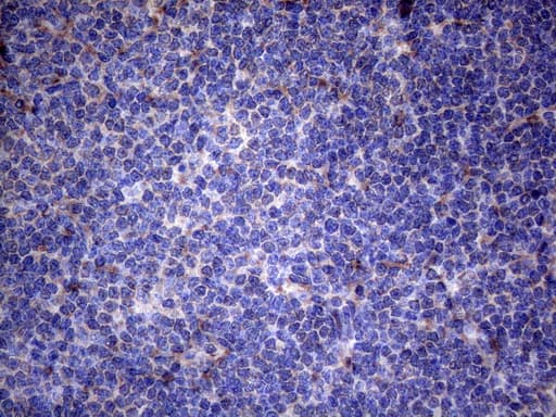TNFRSF10B / Killer / DR5 Antibody (aa203-411, clone OTI5G5)