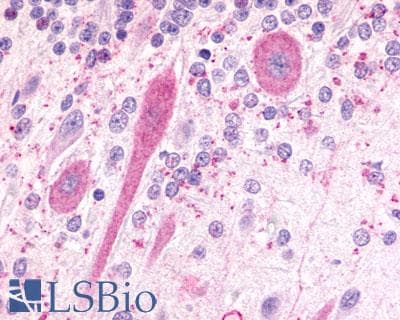 PathPlus™ Polyclonal Rabbit anti-Human FKSG80 / GPR81 Antibody (Extracellular Domain, IHC)