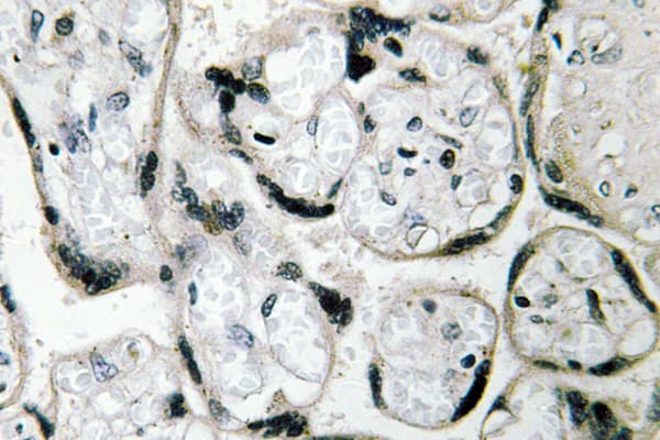 Polyclonal Rabbit anti-Human CYB5R3 / B5R Antibody (Ile169, IHC, WB)