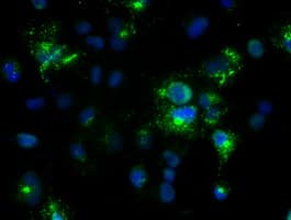 NOG / Noggin Antibody (clone OTI1H8)