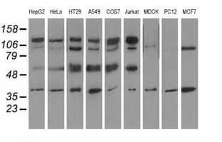 Monoclonal Mouse anti-Human CD5 Antibody (clone OTI6F7, WB)