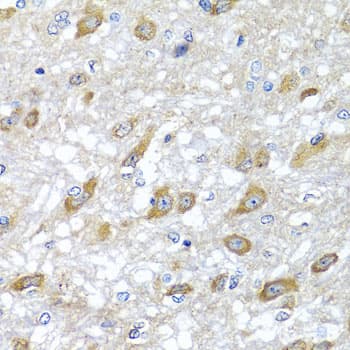 HSPA6 / HSP70B' Antibody