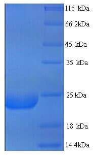 Human LY6G6D Protein (Recombinant His)