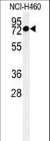 CCDC62 Antibody (aa651-679)