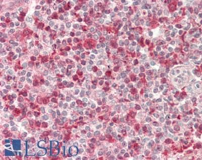 IHC-plus™ Monoclonal Mouse anti-Human SLC2A6 / GLUT6 Antibody (clone 7E3, IHC, IF, WB)
